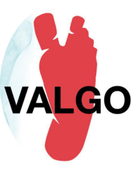 Вальго