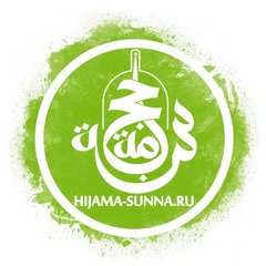 Хиджама Сунна